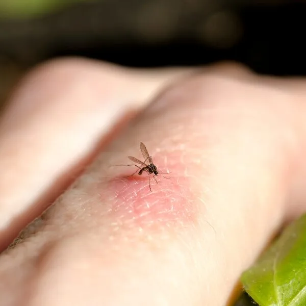 Ανακούφιση απο Τσιμπήματα Εντόμων-Κουνουπιών